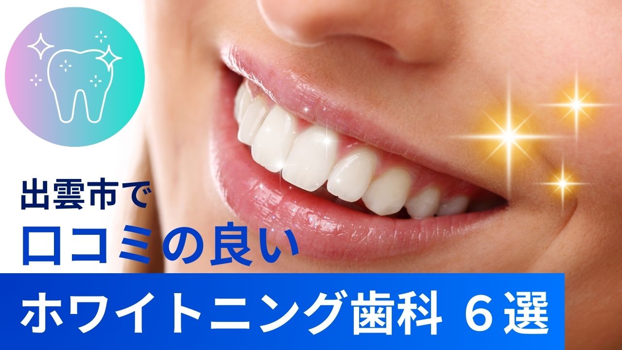 出雲市でおすすめホワイトニング歯科6選|料金・効果・口コミ比較